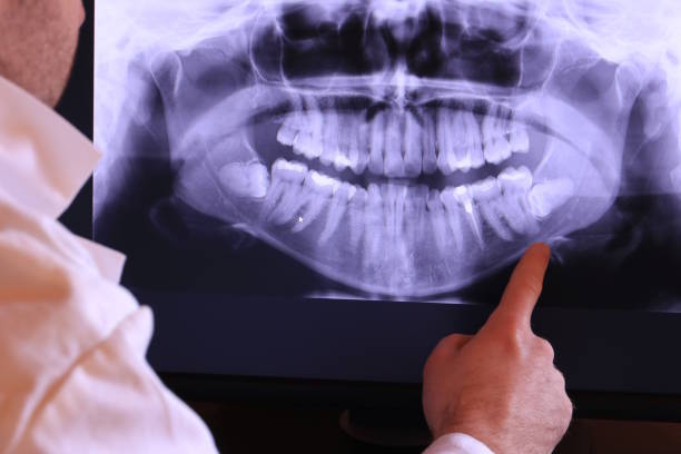 Best Weekend Emergency Dentist in Sandersville, GA